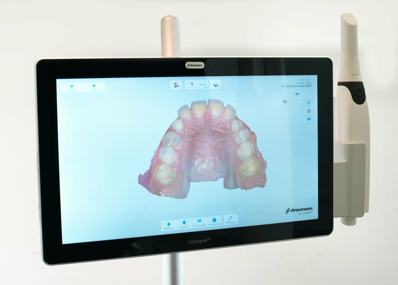 Digitaler Zahnabdruck mit 3D-Scanner Image 1